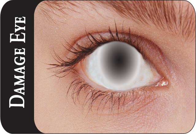 Damage Eye Lens
